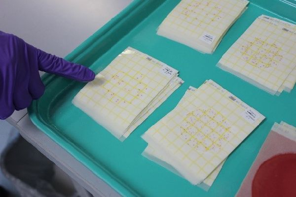 Counting bacteria in milk samples.